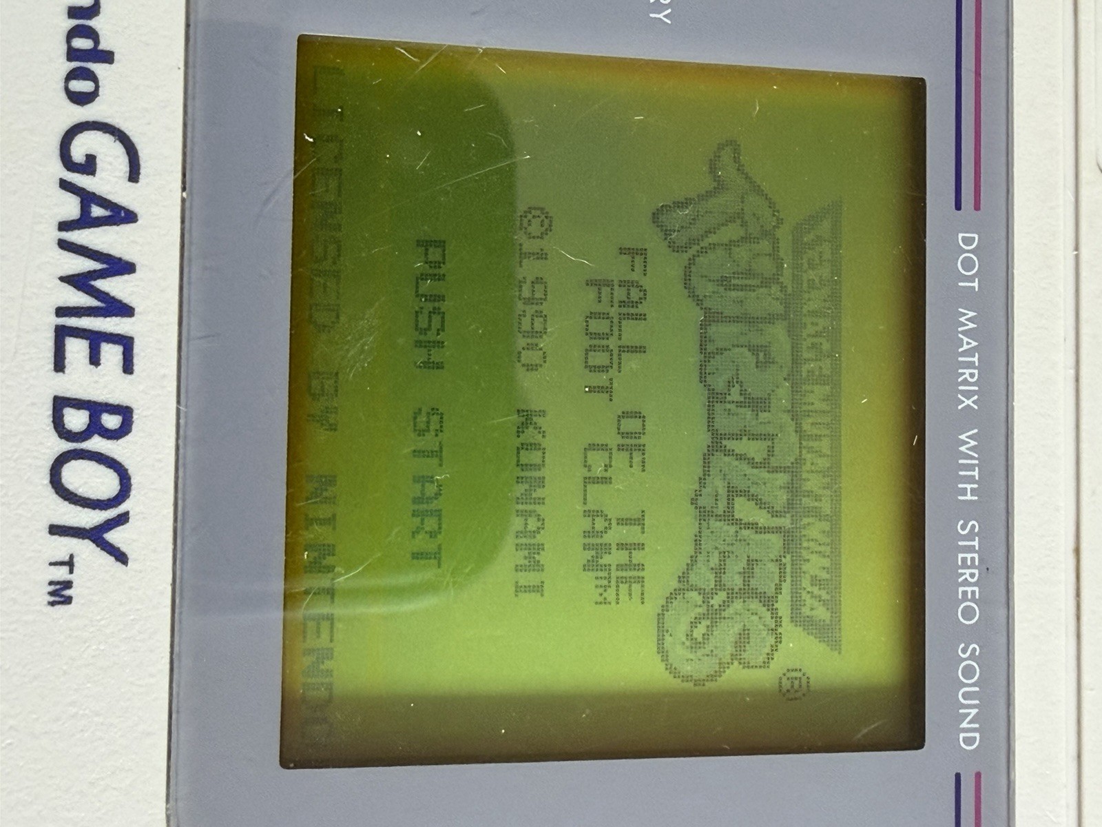 Original Nintendo Game Boy Handheld DMG-01 W/ Original Hard Case – WORKING!