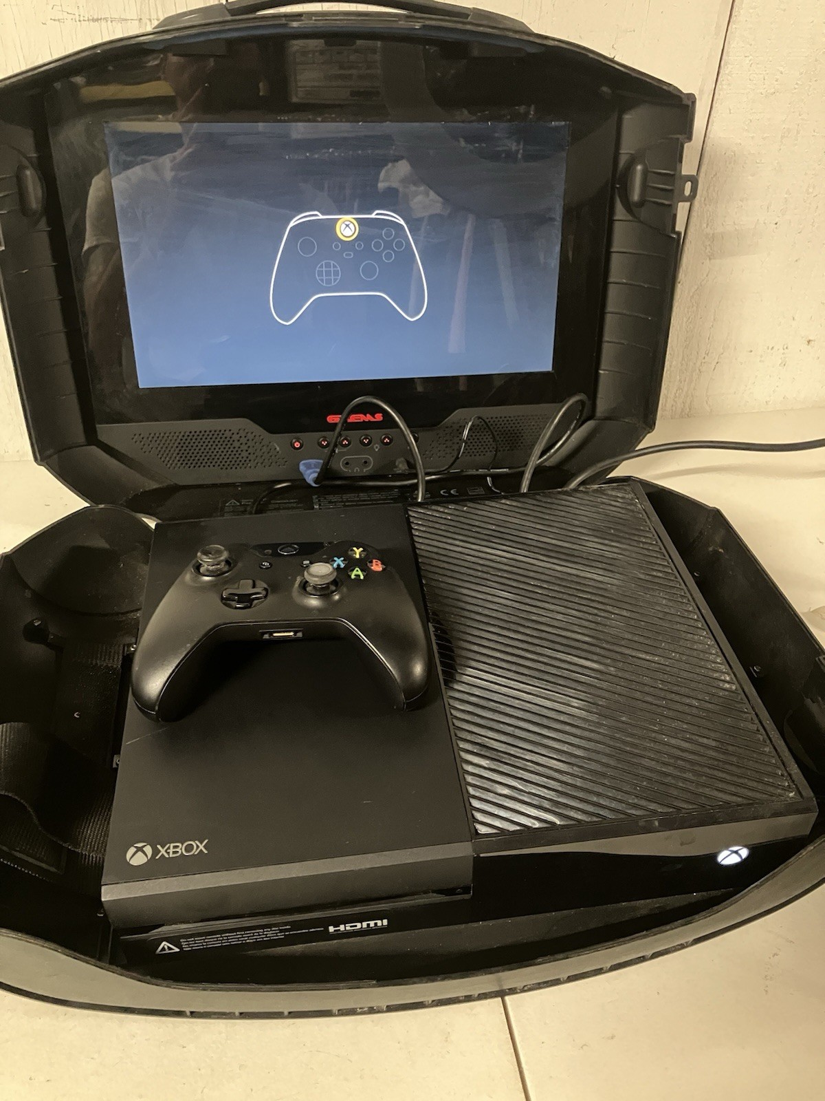 Gaems G155 15.5” Portable Personal Gaming Environment Monitor Xbox One Bundle