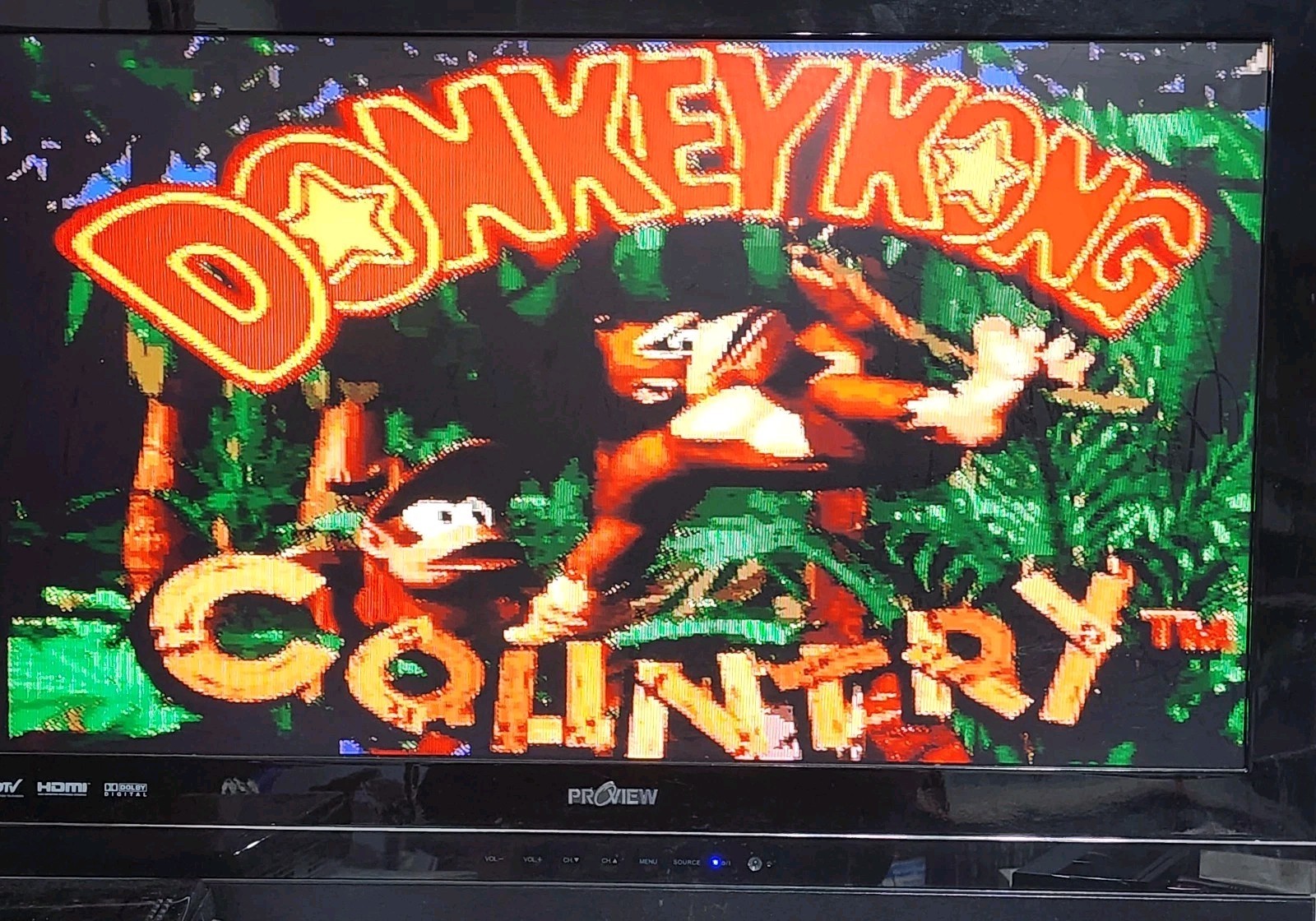 Super NES Donkey Kong Country Set Special Edition SNES CIB TESTED